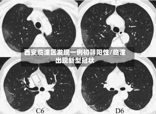 西安临潼区发现一例初筛阳性/临潼出现新型冠状