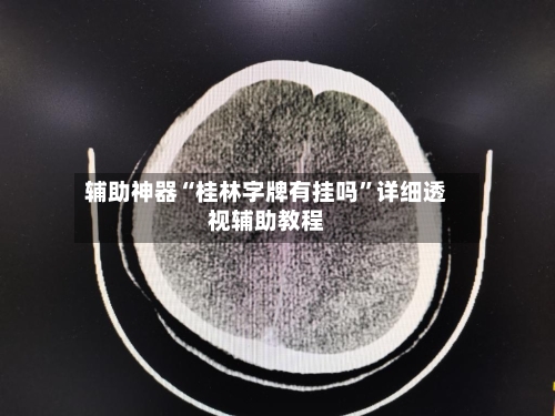 辅助神器“桂林字牌有挂吗”详细透视辅助教程-第3张图片