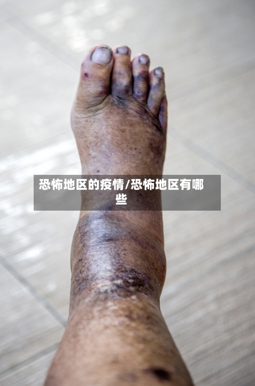 恐怖地区的疫情/恐怖地区有哪些-第3张图片