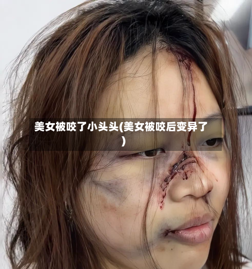 美女被咬了小头头(美女被咬后变异了)