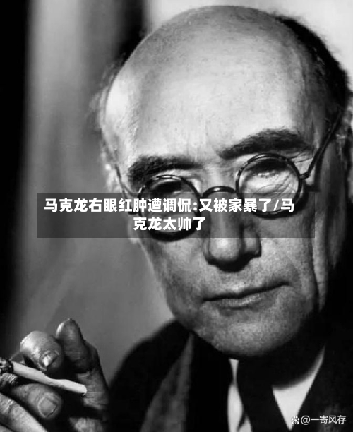马克龙右眼红肿遭调侃:又被家暴了/马克龙太帅了